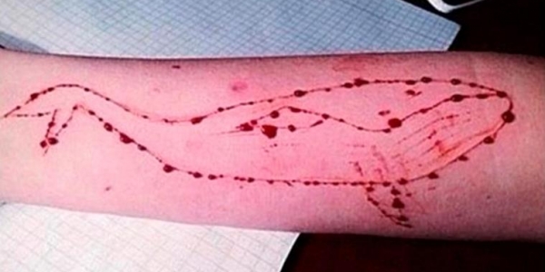 “Blue Whale Challenge” Game Has Already Killed Over 130 Teens; Must know About The Game